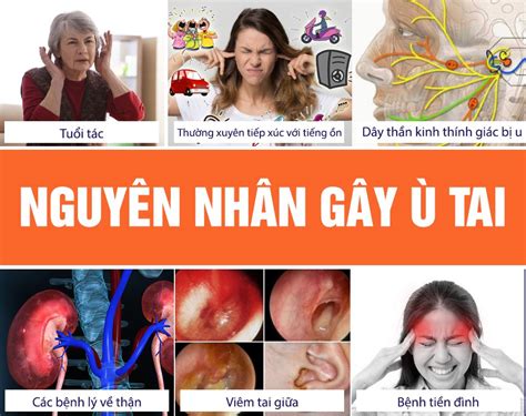 otifar|Thuốc Otifar điều trị viêm tai và ù tai: Thông tin cần biết